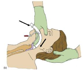 f:id:tsunepi:20160402211942p:plain