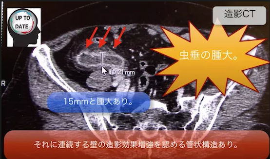 f:id:tsunepi:20160530143822p:plain