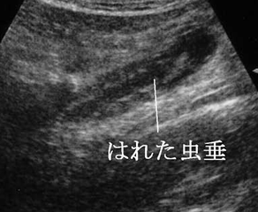 f:id:tsunepi:20160530144110p:plain