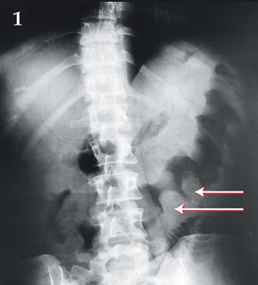 f:id:tsunepi:20160531092609p:plain