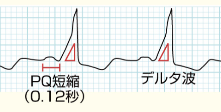 f:id:tsunepi:20160606213932p:plain