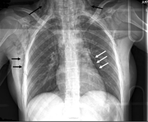 f:id:tsunepi:20160611090728p:plain f:id:tsunepi:20160611090728p:plain