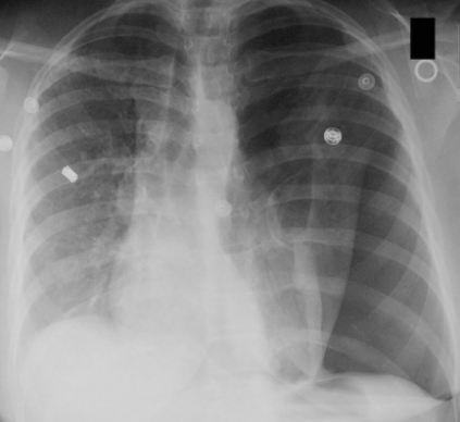 f:id:tsunepi:20160611171409p:plain f:id:tsunepi:20160611171409p:plain