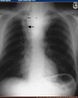 f:id:tsunepi:20160611172834p:plain f:id:tsunepi:20160611172834p:plain