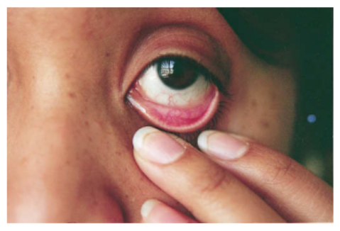 ケモシスの長期的な見通し