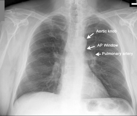 f:id:tsunepi:20160612135428p:plain f:id:tsunepi:20160612135428p:plain