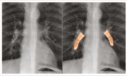 f:id:tsunepi:20160612165853p:plain