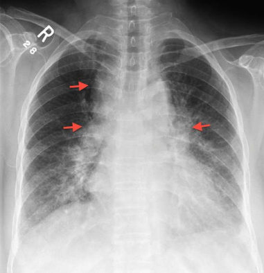 f:id:tsunepi:20160615121024p:plain