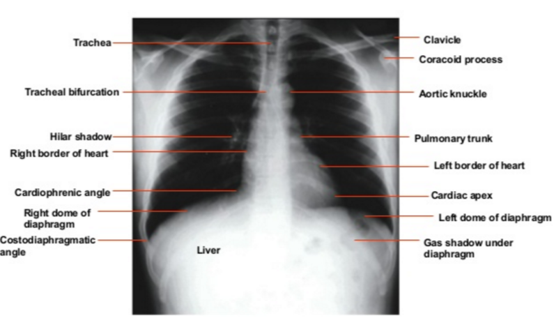 f:id:tsunepi:20160616132943p:plain