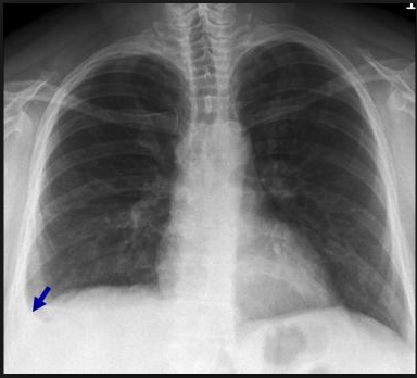 f:id:tsunepi:20160617112853p:plain f:id:tsunepi:20160617112853p:plain