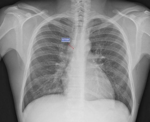 f:id:tsunepi:20160617131920p:plain