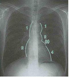 f:id:tsunepi:20160618084634p:plain f:id:tsunepi:20160618084634p:plain