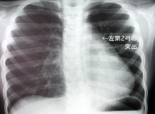 f:id:tsunepi:20160618094756p:plain f:id:tsunepi:20160618094756p:plain