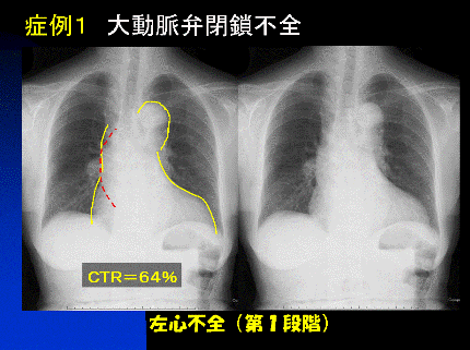 f:id:tsunepi:20160618100434p:plain f:id:tsunepi:20160618100434p:plain