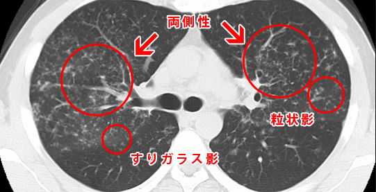 f:id:tsunepi:20160619063902p:plain