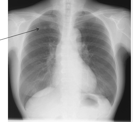 f:id:tsunepi:20160619064225p:plain