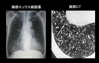 f:id:tsunepi:20160619120956p:plain