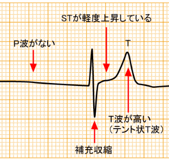 f:id:tsunepi:20160619122607p:plain f:id:tsunepi:20160619122607p:plain