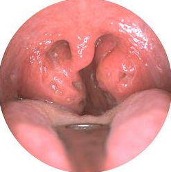 f:id:tsunepi:20160620151346p:plain f:id:tsunepi:20160620151346p:plain