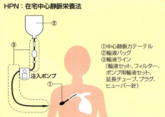 f:id:tsunepi:20160623113318p:plain