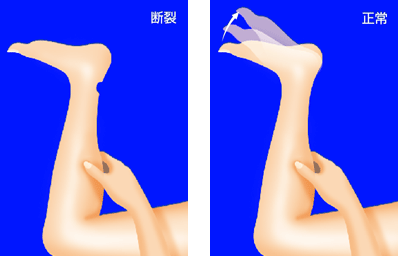 f:id:tsunepi:20160802131318p:plain