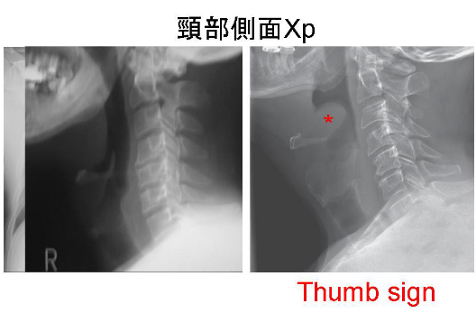 f:id:tsunepi:20160803200431p:plain f:id:tsunepi:20160803200431p:plain