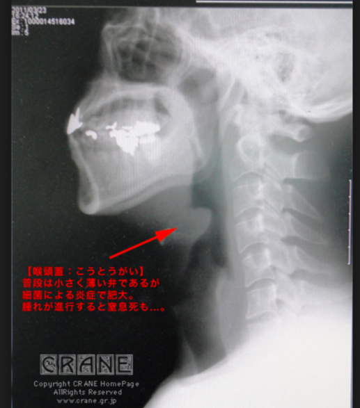 f:id:tsunepi:20160803200612p:plain f:id:tsunepi:20160803200612p:plain