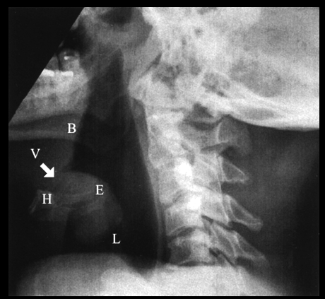 f:id:tsunepi:20160803200948p:plain f:id:tsunepi:20160803200948p:plain