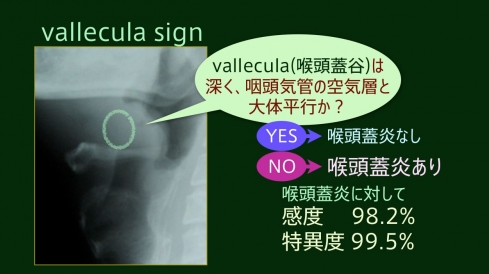 f:id:tsunepi:20160803201435p:plain f:id:tsunepi:20160803201435p:plain