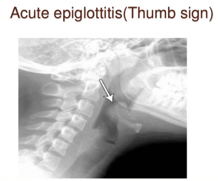 f:id:tsunepi:20160803201642p:plain f:id:tsunepi:20160803201642p:plain