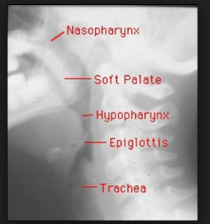 f:id:tsunepi:20160803201913p:plain