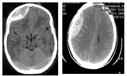 f:id:tsunepi:20160820093106p:plain f:id:tsunepi:20160820093106p:plain