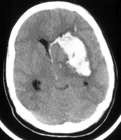 f:id:tsunepi:20160820093644p:plain f:id:tsunepi:20160820093644p:plain