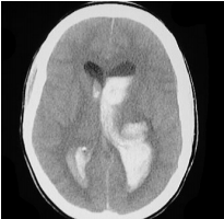 f:id:tsunepi:20160820094401p:plain f:id:tsunepi:20160820094401p:plain