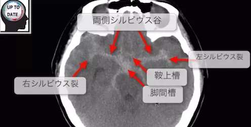 f:id:tsunepi:20160821052621p:plain f:id:tsunepi:20160821052621p:plain