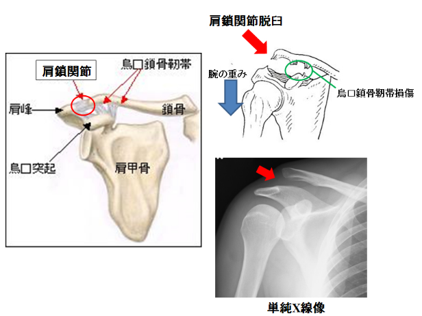 f:id:tsunepi:20160902220731p:plain