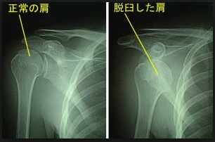 f:id:tsunepi:20160902221918p:plain