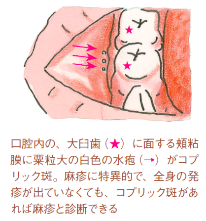 f:id:tsunepi:20160914213042p:plain