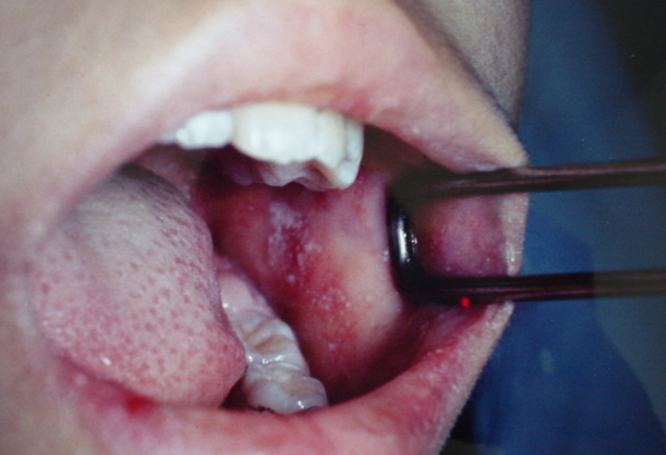 f:id:tsunepi:20160914213553p:plain