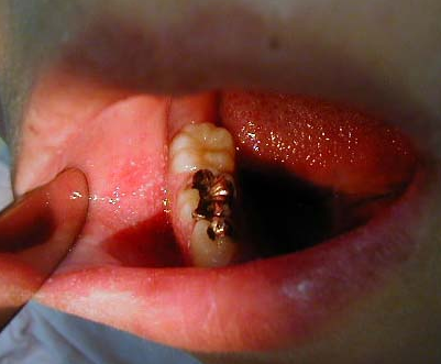 f:id:tsunepi:20160914213701p:plain