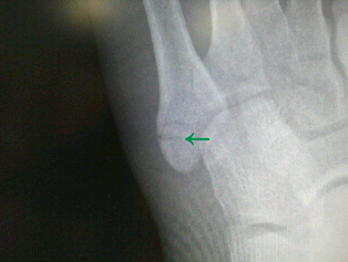 f:id:tsunepi:20161103064911p:plain