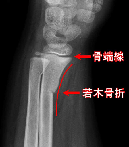 f:id:tsunepi:20161103065132p:plain