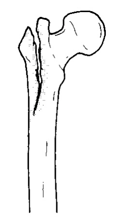 f:id:tsunepi:20161103065948p:plain