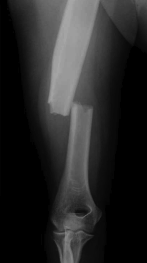 f:id:tsunepi:20161103070306p:plain