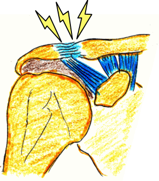 f:id:tsunepi:20161103094057p:plain