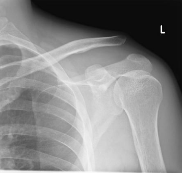 f:id:tsunepi:20161103094551p:plain