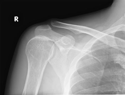 f:id:tsunepi:20161103094822p:plain