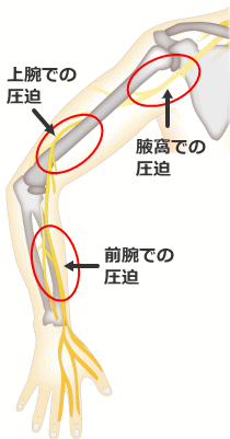f:id:tsunepi:20161116201127p:plain