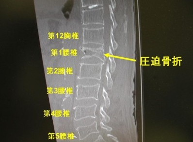 f:id:tsunepi:20161119112812p:plain f:id:tsunepi:20161119112812p:plain
