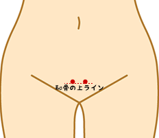 f:id:tsunepi:20161119144522p:plain